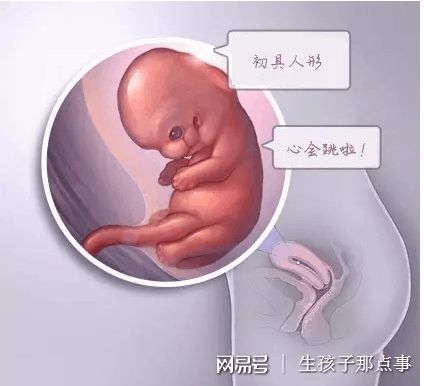 男性因素